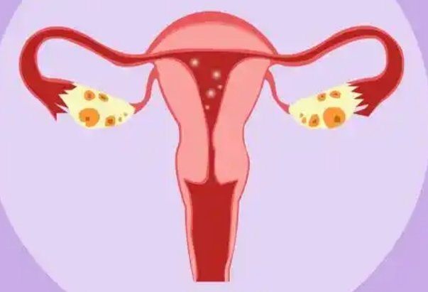 重度鞍形子宫可以做第三代试管婴儿移植囊胚吗？