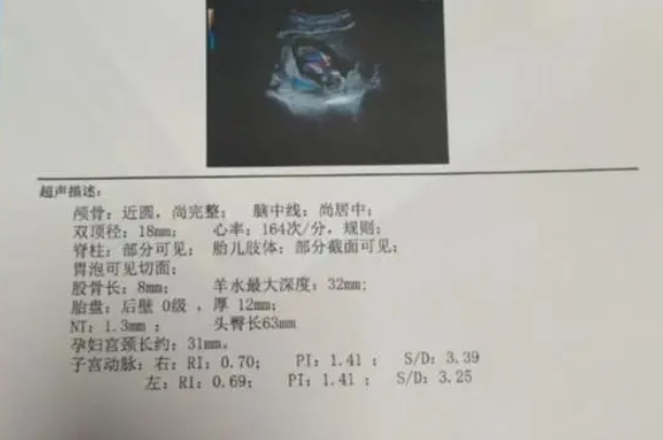 nt值1.4mm是男孩可能性大还是女孩？