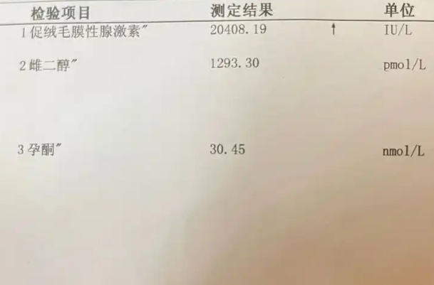 双胞胎HCG翻倍多少是正常，通常可能在48小时内翻2-3倍