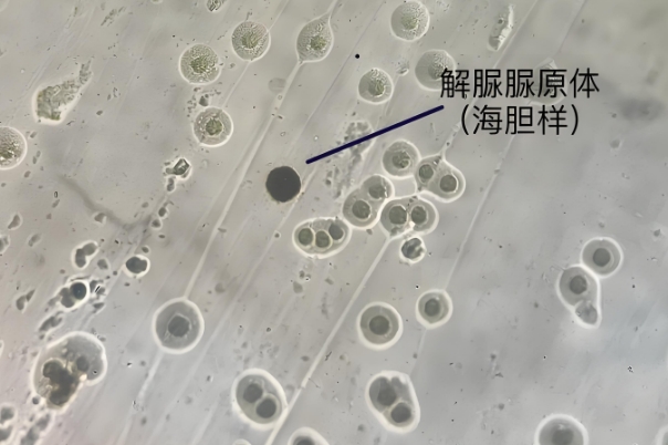 解脲支原体不孕几率比正常人要低，男女双方都要注意