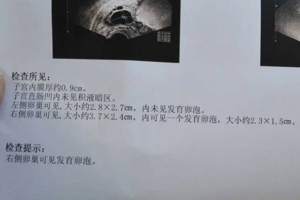 卵泡监测是不需要空腹的