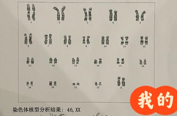 两次胎停后再次备孕需要做什么检查，染色体核型分析不可少