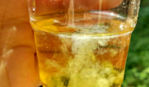 用晨尿和医用酒精某性别的准确率怎么样？