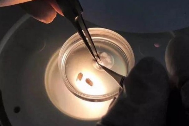 试管胚胎三级会容易出现生化妊娠吗？