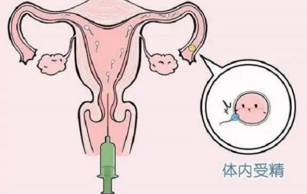 实验室工作人员会对精液进行洗涤