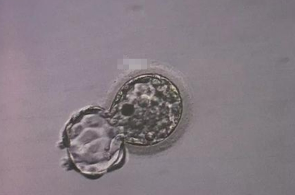 胚胎质量等级表对照表详解：如何科学评估试管婴儿成功率