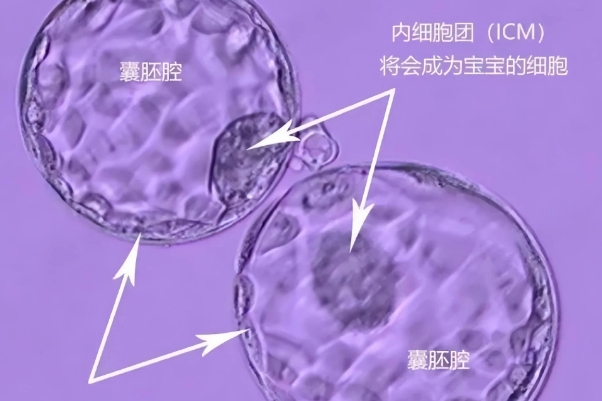 实验室设备水平会影响形成胚胎的效率