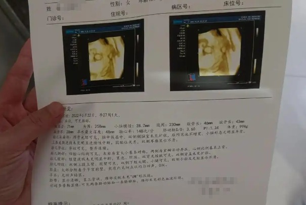 通过四维彩超报告单子怎么3秒钟快速看出胎儿是男还是女呢？