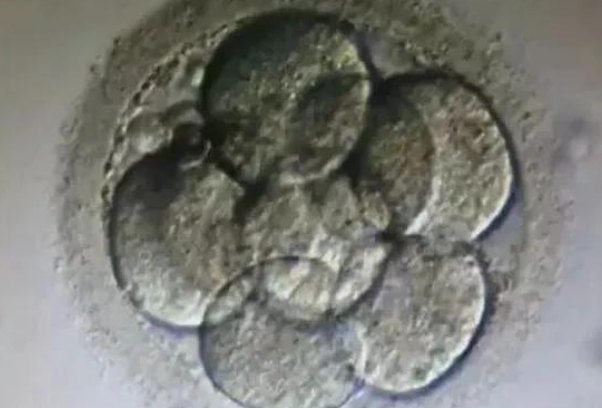 胚胎质量会影响胚胎等级划分